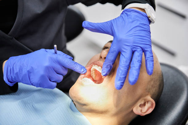 Best Emergency Wisdom Tooth Extraction in Carlinvle, IL